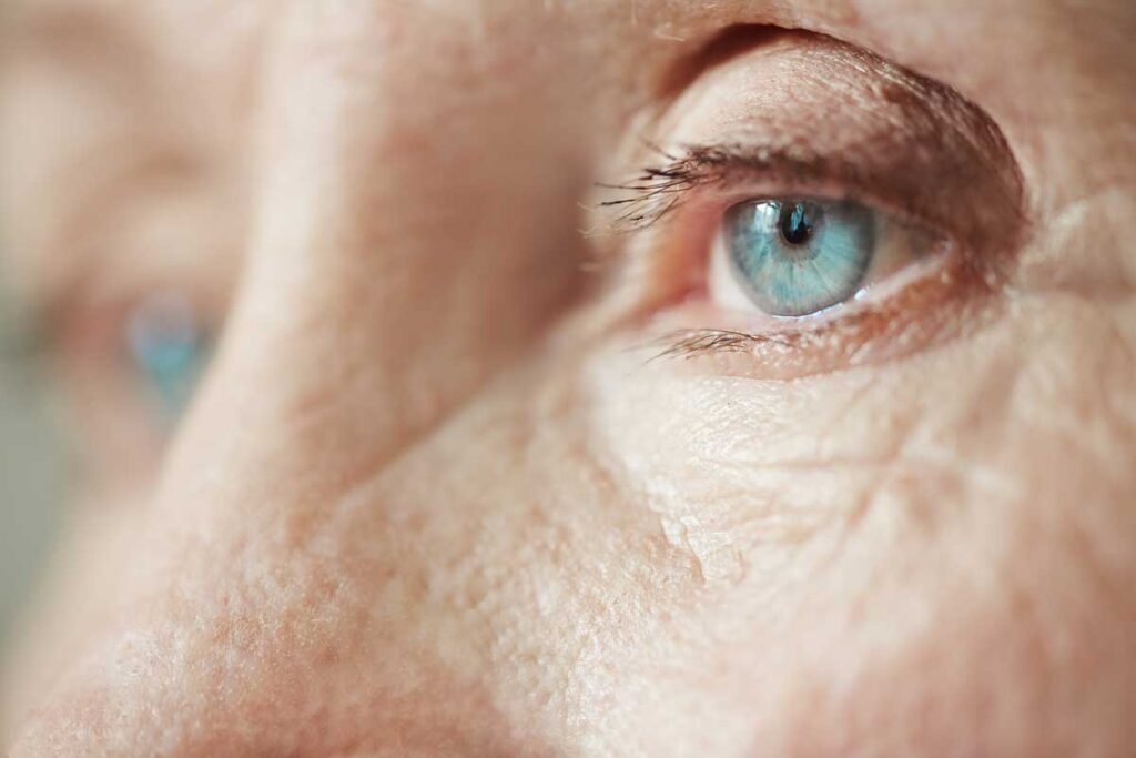 Veja neste artigo a informação essencial sobre cataratas oculares. Saiba o que são as cataratas, o que as causa, qual o seu impacto e como tratar as cataratas.
